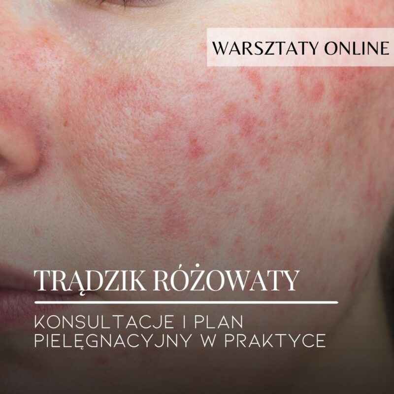 Warsztaty online: Rosacea. Konsultacje i plan pielęgnacyjny w praktyce.