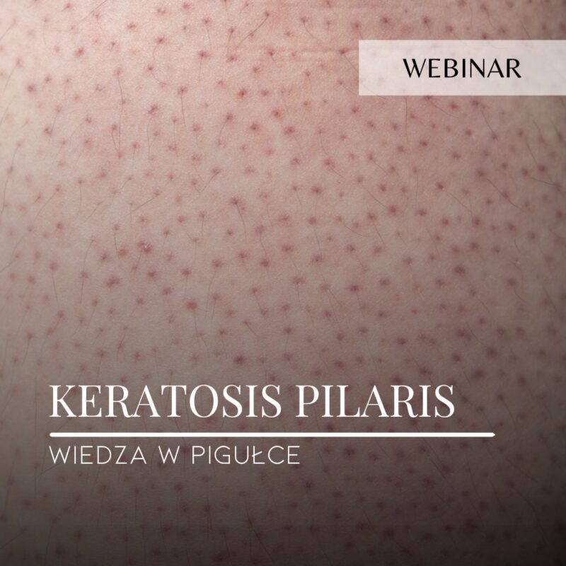 Webinar_Keratosis pilaris