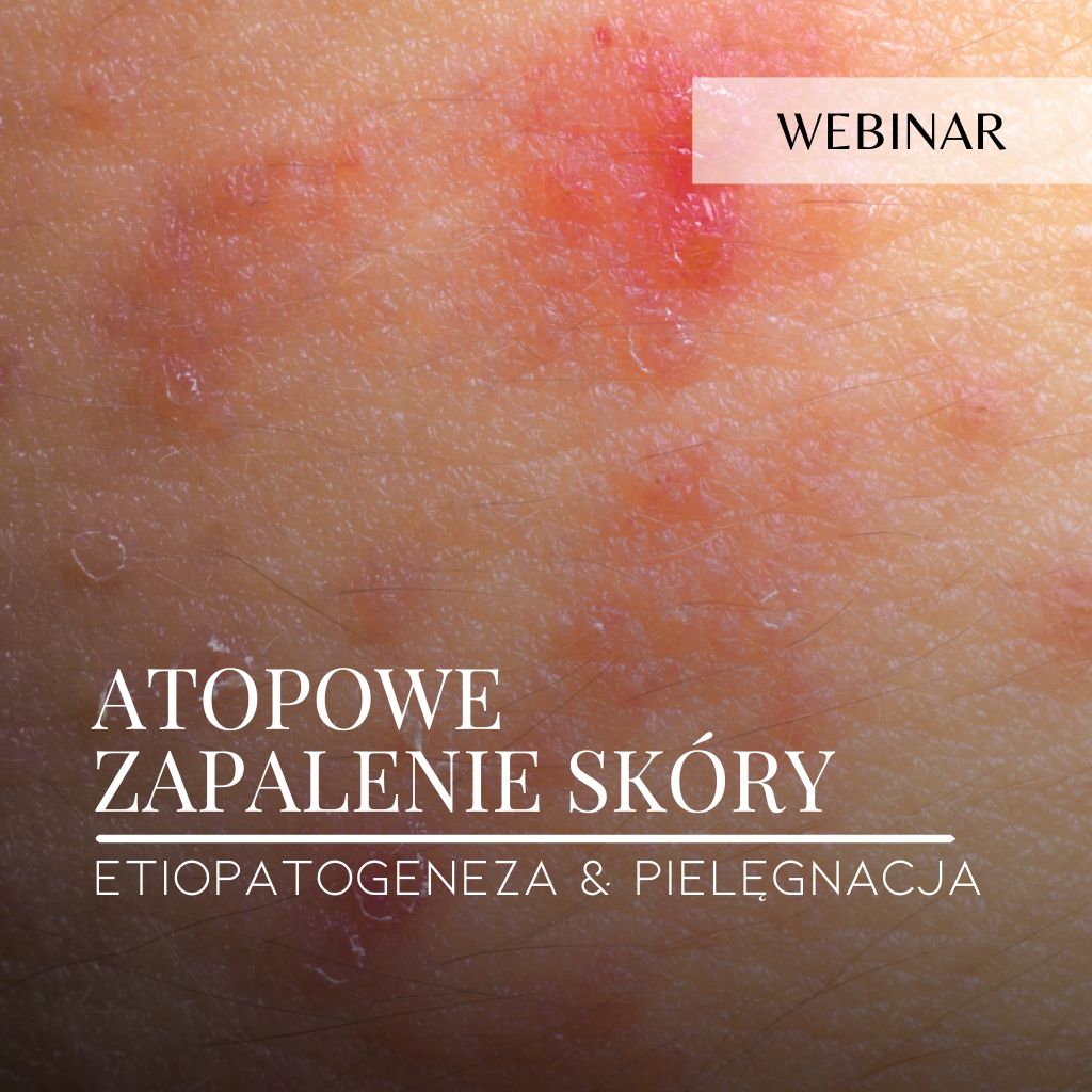 Webinar_Atopowe zapalenie skóry