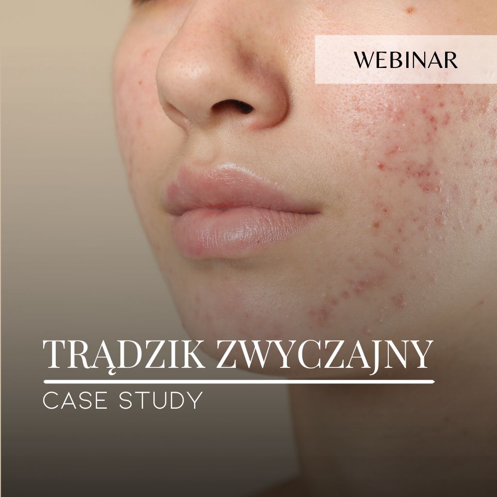 Webinar_Case study_Trądzik