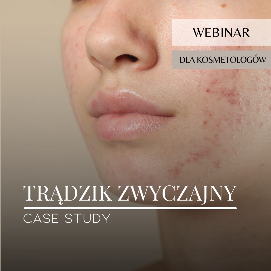 Webinar_Case study_Trądzik