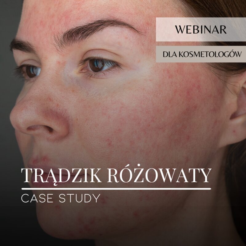 Webinar_Case study_Trądzik różowaty
