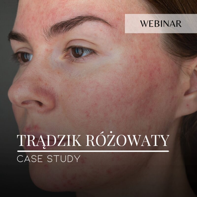Webinar_Case study_Trądzik różowaty