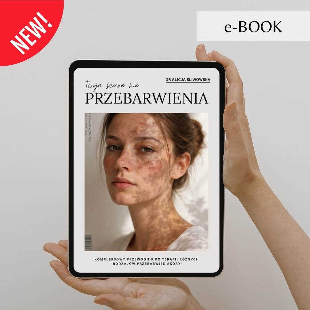 e-Book. Twoja scura ma przebarwienia.
