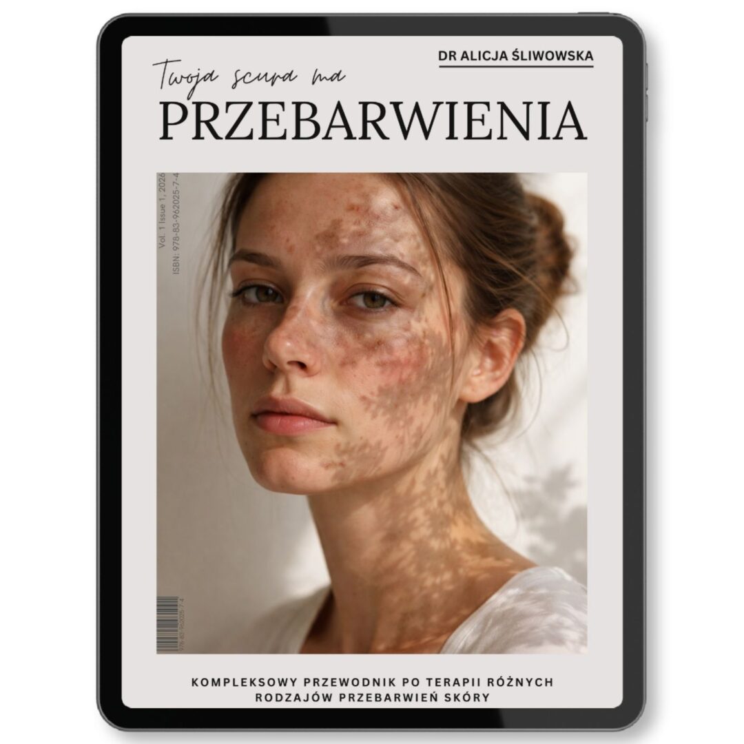 e-Book. Twoja scura ma przebarwienia.