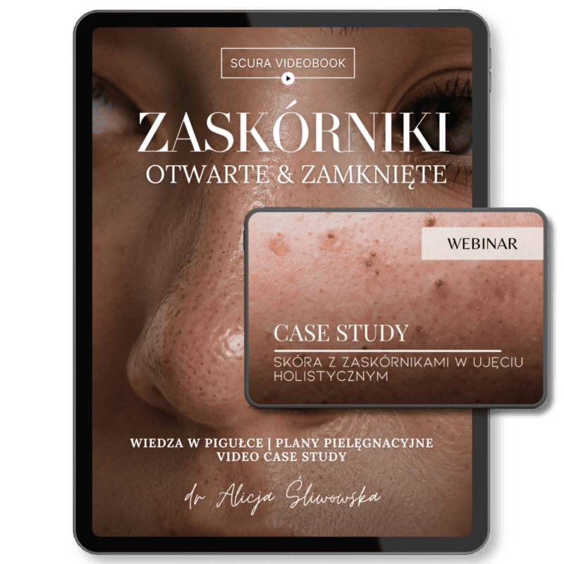 Videobook. Zaskórniki otwarte & zamknięte. Kompendium wiedzy.