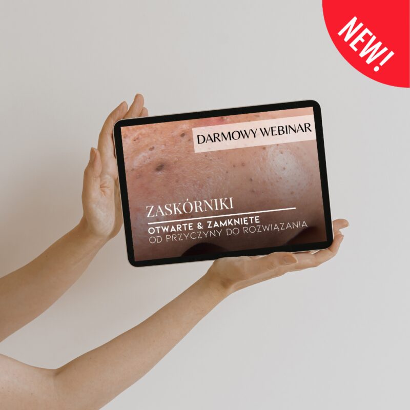 Webinar. Zaskórniki otwarte & zamknięte - 7 dni dostępu do nagrania